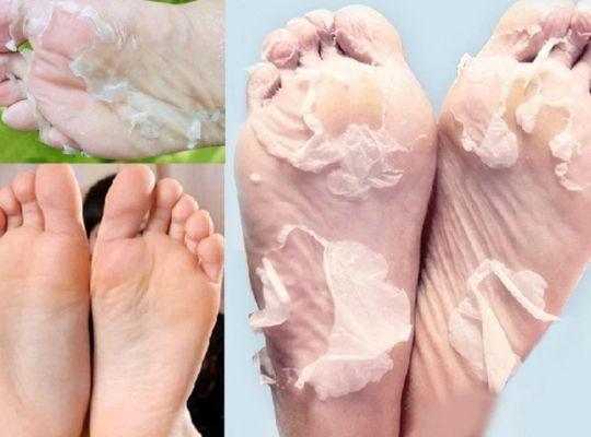 Deep Moisturizing & Exfoliating Feet Peel Mask (1 Pair Set)